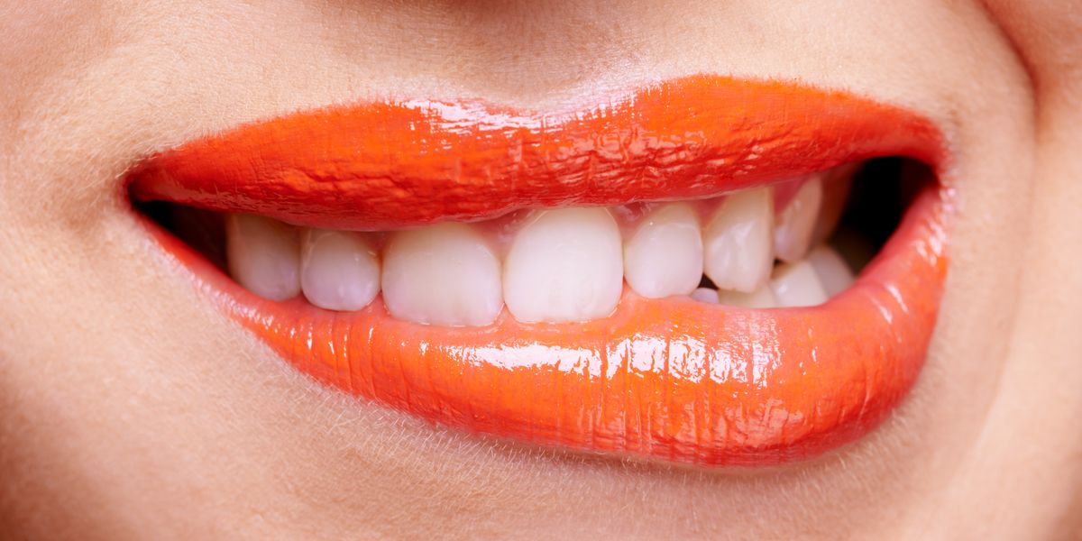 People Are Getting Smile Makeovers to Replicate Their Favorite Celebrity's Teeth