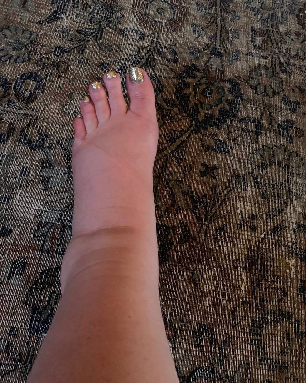Jessica Simpson's Swollen Foot Should Host the 2019 Oscars