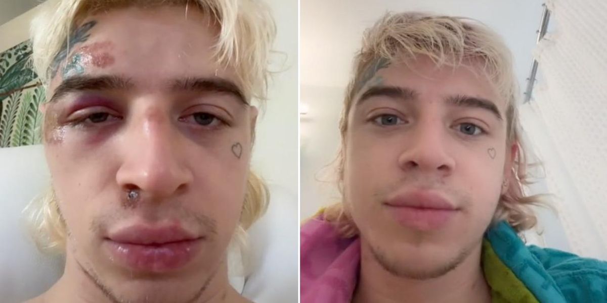 TikToker Icy Wyatt Arrested for Allegedly Assaulting Police Officer