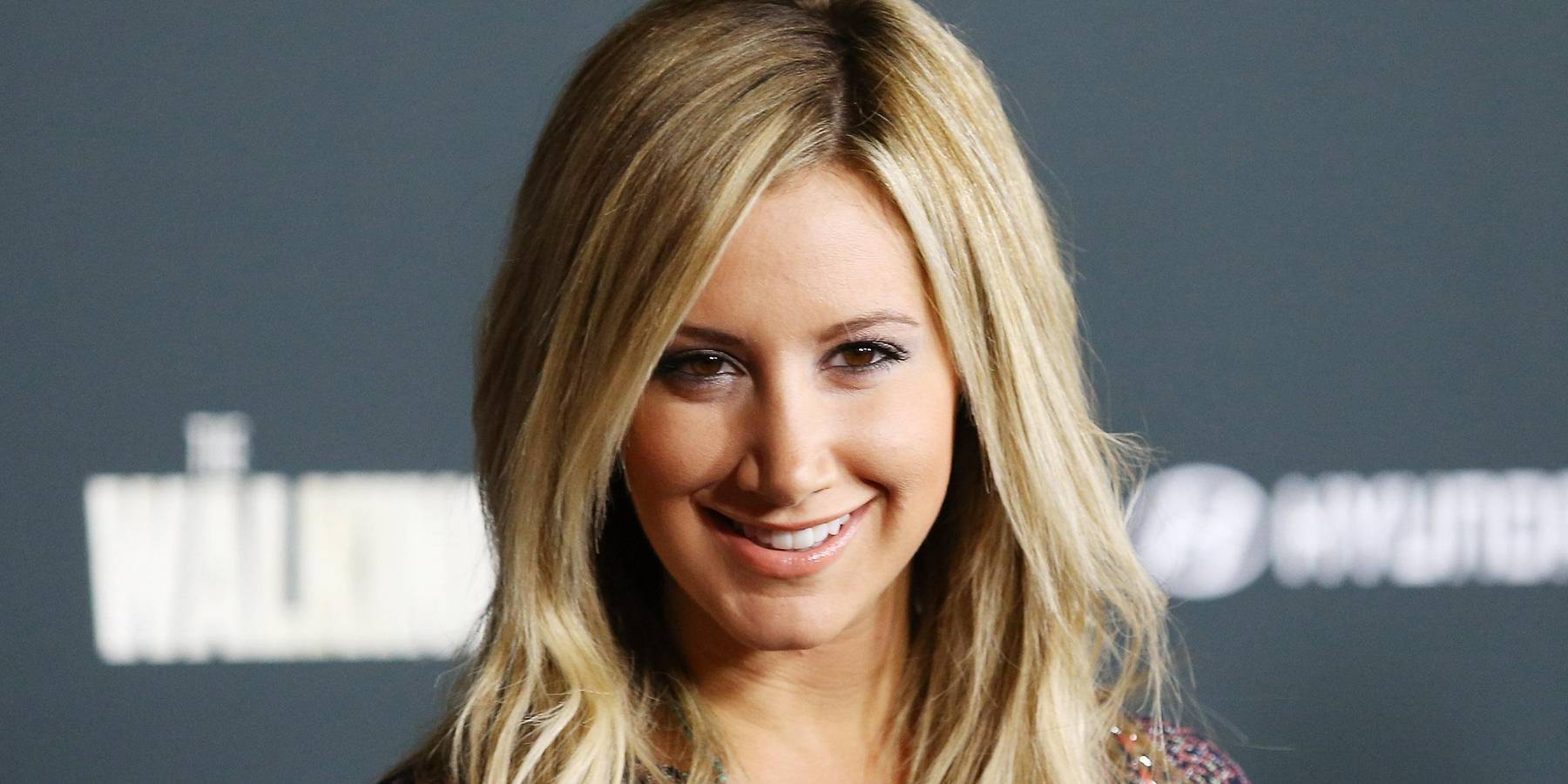 Ashley Tisdale Reveals She Has Alopecia